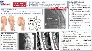 4 RM19 2V NEUROCIRUGÍA MIELOPATIA COMPRESIVA MALFORMACIONES DE CRANEO [upl. by Nevaj]