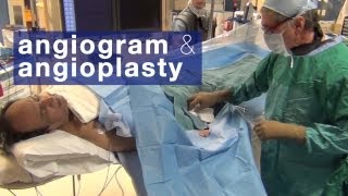 Angiogram amp angioplasty what to expect [upl. by Analli]