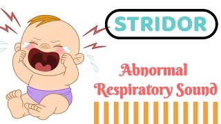 STRIDOR  Audible Respiratory sound [upl. by Haggerty]