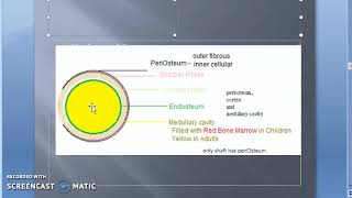 Pathology 825 e Pyogenic Osteomyelitis Pathogenesis Gross Sequestrum [upl. by Nairred]