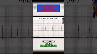 Atrial Fibrillation Causes Symptoms and Treatments  Explained by a Medical Professional [upl. by Ennairoc]