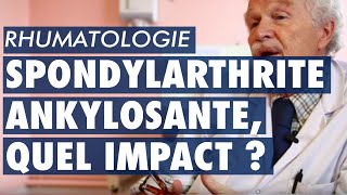 Spondylarthrite ankylosante quel impact pour les patients [upl. by Lamont175]