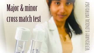 Cross match test major and minor [upl. by Enilarac]