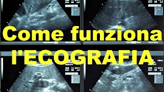 Come funziona lECOGRAFIA [upl. by Johen]