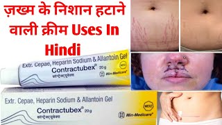 Contractubex 20g Cream Uses in Hindi  Stretch Marks Scar Removal Cream [upl. by Aihsema]