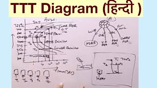 Time Temperature Transformation TTTDiagram हिन्दी [upl. by Nairret]