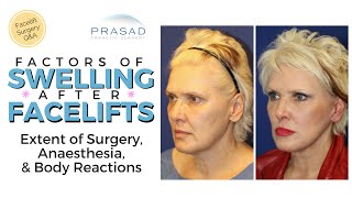 Contributing Factors of Extended Swelling after a Facelift [upl. by Ailak897]