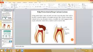 Operative Dentistry Lec 8 Dental Cements liner materials [upl. by Wilfrid]