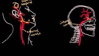 Temporal Arteritis [upl. by Kulsrud277]