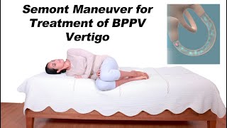 Semont Maneuver for BPPV Vertigo Treatment Alternative to Epley Maneuver [upl. by Mildred]