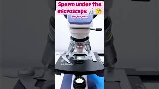 sperm under microscope🔬😨sciencefacts concept futuredoctors shorts [upl. by Enened471]