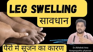 Best Homeopathic Medicine For Oedema How To Rid Of Swelling Easily ।2024👇 [upl. by Nama528]