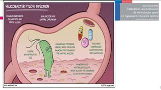 EUNACOM UPV  Gastroenterología 01 [upl. by Assennav]