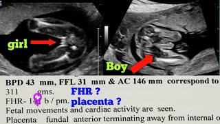 Pregnancy Ultrasound Report Kaise Dekhe  Pregnancy Ultrasound Report Boy Or Girl  Fhr Of Male Baby [upl. by Evetta278]