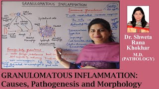 Granulomatous Inflammation Causes Pathogenesis and Morphology  Immune and Foreign body granulomas [upl. by Eatnuhs]