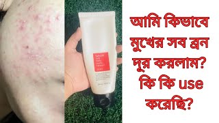 cosrx salicylic acid daily gentle cleanser reviewhow to use cosrx salicylic acid cleanse Bangla [upl. by Nylatsirhc]