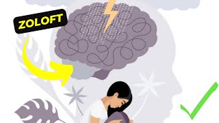 Zoloft How It Works and Its Effects on Your Mental Health [upl. by Crisey]