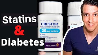 Statins amp Diabetes A StepbyStep Guide [upl. by Gabbi]