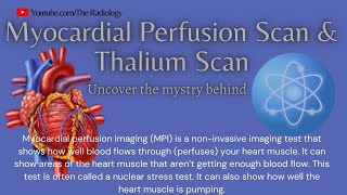 Myocardial Perfusion Scan amp Thallium Scan myocardialinfarction heartattack [upl. by Voltz39]