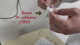 Remove abdominal fluid ascites  Paracentesis  Ascitic fluid aspiration [upl. by Ahron]