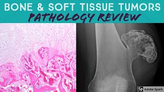 Bone amp Soft Tissue Pathology Board Review 21 Classic Cases [upl. by Rephotsirhc711]