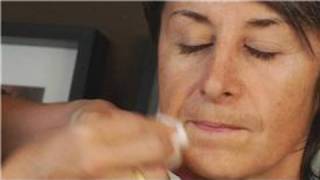 Skin Care Acne  How to Get Rid of Brown Spots on Face [upl. by Bullough]