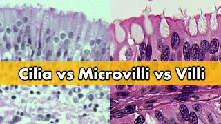 Cilia vs Microvilli vs Villi [upl. by Eey435]