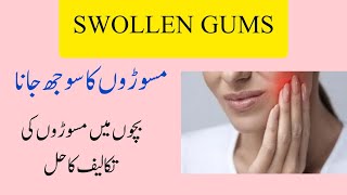 Home Remedies For Swollen Gums  مسوڑھوں کا سوجھ جانا [upl. by Zosema844]