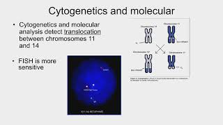 Update on RelapsedRefractory Mantle Cell Lymphoma  LRF Webinars [upl. by Yonina]