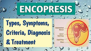 Encopresis Symptoms Types Criteria Diagnosis DD amp Management  Pediatrics [upl. by Collbaith]