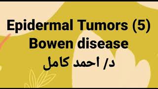 5 Bowen disease [upl. by Eserehs186]