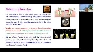 Managing of Insufficient Ferrule Effect [upl. by Stieglitz90]