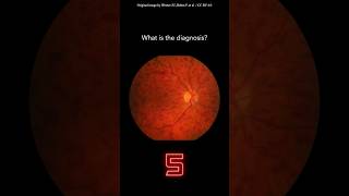 Fundoscopy Question 9 [upl. by Drofnil]