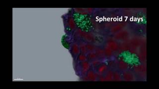 3D cell culture breast cancer cell line  MCF 7 [upl. by Esinert]