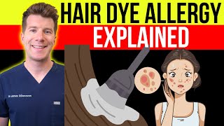 Doctor explains HAIR DYE ALLERGIC REACTION  Causes symptoms amp treatment [upl. by Rafaelle800]