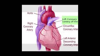 Anomalous Coronary Artery  Symptoms and Causes  Diagnosis  Treatment healthcare heartattack [upl. by Burta265]