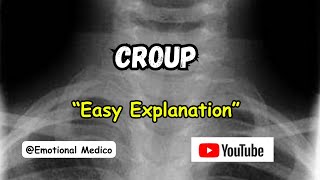 Croup  Acute LaryngoTracheoBronchitis  ENT  emotionalmedico [upl. by Cleopatre407]