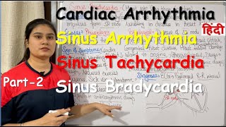 Cardiac Arrhythmia  Part2  Sinus Arrhythmia  Sinus Tachycardia  Sinus Bradycardia  Treatment [upl. by Dyane]