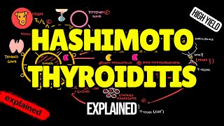 HASHIMOTO THYROIDITIS Pathogenesis Clinical Symptoms Treatment [upl. by Jaf658]