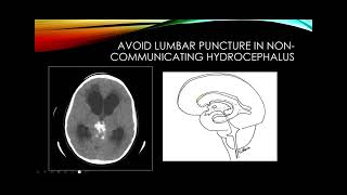 Cerebrospinal fluid [upl. by Aittam]