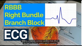 Understanding Right Bundle Branch Block RBBB on ECG Causes Symptoms and Treatment [upl. by Kantor304]