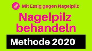 Nagelpilz Behandlung Essig gegen Nagelpilz 2020 entfernen loswerden [upl. by Nnylear]