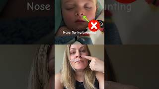 What does CROUP sound like amp Home Treatment for Croup [upl. by Elwina780]