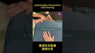 Polymyalgia Rheumatica PMR [upl. by Arda]