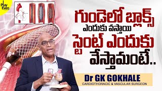 స్టంట్ ఎందుకు వేస్తామంటే  Cardiothoracic Surgeon Dr Gopala Krishna Gokhale About Heart Stents [upl. by Vahe]