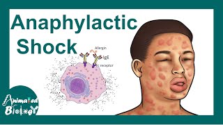 Anaphylactic shock  Anaphylactic Reaction Symptoms and Treatment [upl. by Amadus]