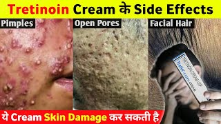 Tretinoin Cream के ये Side Effects आप नहीं जानते होगे 😱 [upl. by Aratahs525]