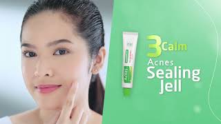 TVC Acnes Treatment Series 15s [upl. by Ajam]