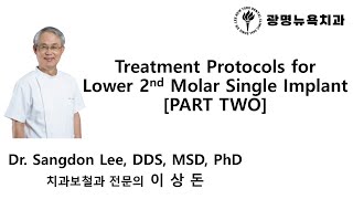 Treatment Protocols for Lower 2nd Molar Single Implant PART 2 [upl. by Akcirred]