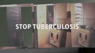 Images to Stop Tuberculosis [upl. by Artinad801]